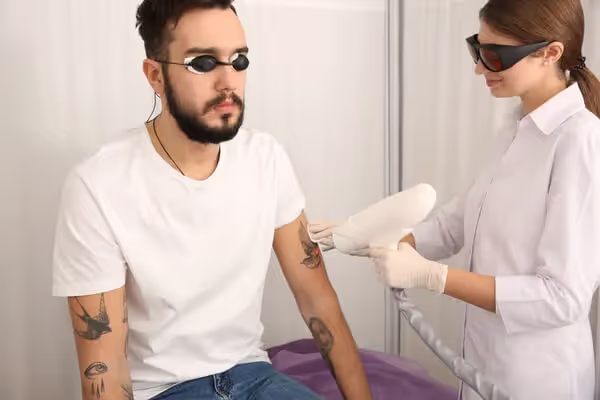 Laser Tattoo Removal Aftercare Tips