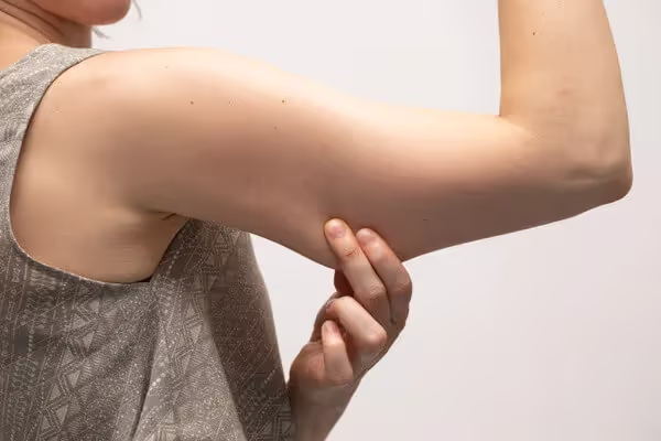 No Surgery Arm Makeover! How To Tighten Saggy Skin On Arms