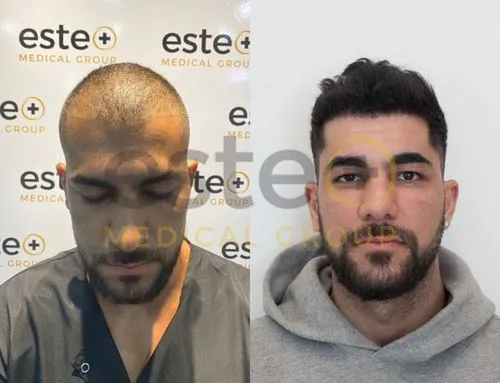 65ba5ab0db66cbc0e15006ac_64356632a05bcf2b955ce59e_Group 1088-p-500