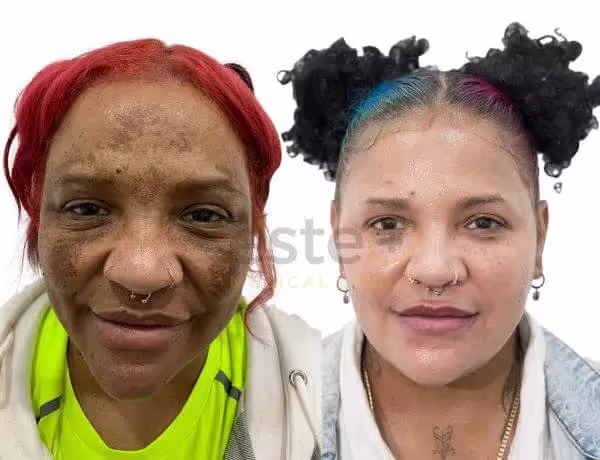 65bb80d290cc33c57ccc8764_650d7807ea1feb6b82bf864b_Collette-Before-and-after