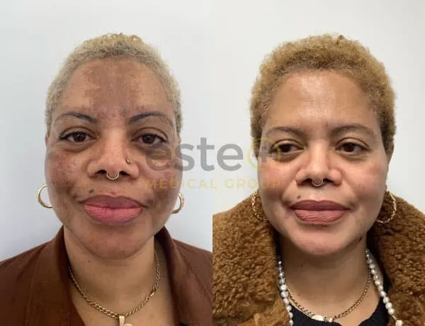 65bbc7386deff2ebb769f433_649aeb17b722a38d657611f4_Group 1092