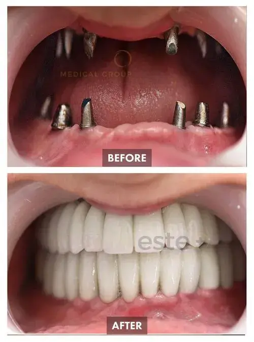 663b94c4edbb28da3f8a231b_65c4b86610420b83b783fa4f_659bda7586ab236205b23a60_Group 1108-p-500