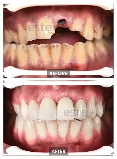 663b94c4fc827983ebdd59e5_65c4b86a94fe513fb1943939_659bda76133d5685da11741b_Group 1107-p-500 (1)