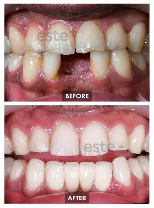 663b94c7721d843f7613ae74_65c4b85e47a97a71d073f729_659bda78f597f5a11339cdb6_Group 1109-p-500