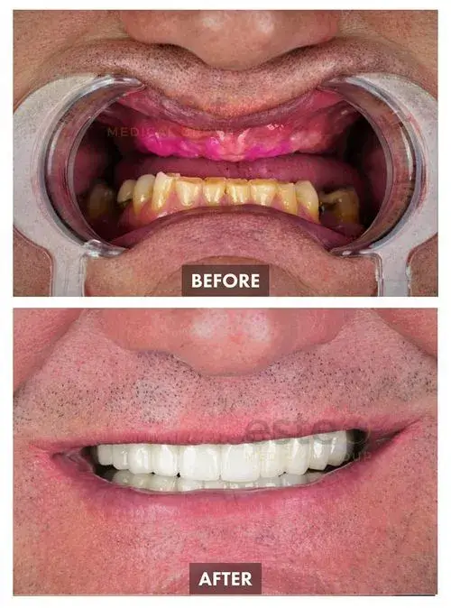 663b94c895b36074d64b9daa_65c4b8602f4b9d4b16971f21_659bda79163194ea5fbbf9ce_Group 1105-p-500