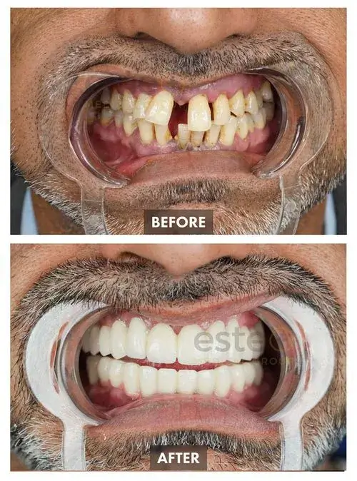 663b94c8c5b51c74fd47f4f1_65c4b86465b22c6beec6091e_659bda78dfa99d9ceeb4f4b2_Group 1106-p-500