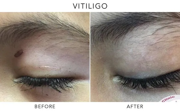 668296ed0a5ff438e607c20f_62039936123c94643c78de60_Before-After-V01