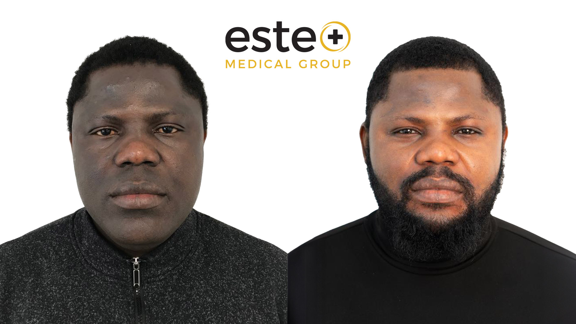before and after result