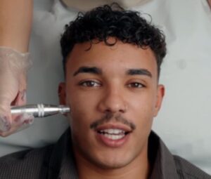 Traitors’ Freddie Fraser Loyal to Este EP Needling Facial