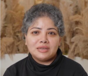 Alopecia Hair Loss: One Woman’s Robotic Hair Transplant Results After 6 Months