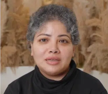 Robotic dhi hair transplant