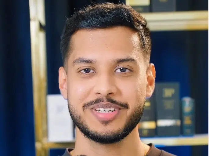 Salil’s Robotic DHI Hair Transplant Results
