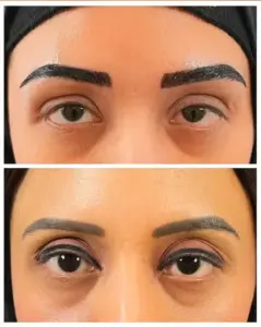 Natural-Looking Brows Possible In 1 Day