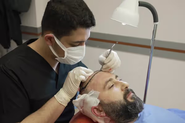 Compare Hair Transplant Clinics in Leeds