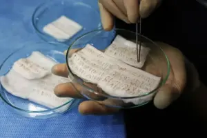 Comparing Hair Transplant Clinics in Edinburgh