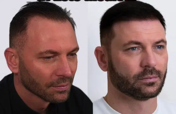 Phil Bardsley