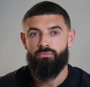 Thomas Hair and beard result with robotic dhi treatment